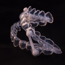 Custom oral appliance