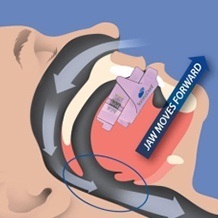 Animation of airway function