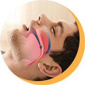 Airway animation over man's profile