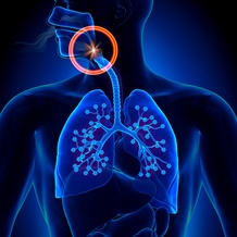 obstructed airway illustration