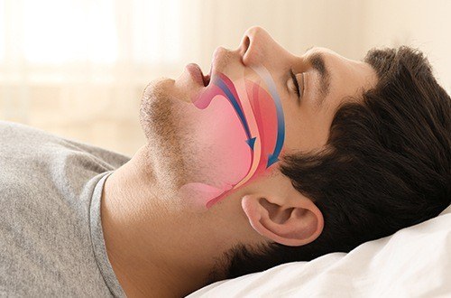 Airway animation overlaying man's profile