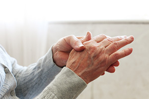 Close-up of hands with rheumatoid arthritis