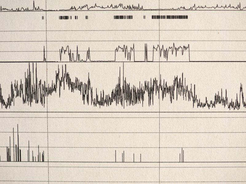 Sleep apnea test results